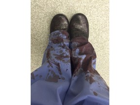 This image recently tweeted by Dr. Kirstin M. Gee, shows her posing in her blood stained scrubs after treating a patient related to gun violence on Oct. 11, 2016.  The photos from doctors came quickly and in succession: blood-stained operating rooms, blood-covered scrubs and shoes, bullets piercing body parts and organs. The tweets were an emotional response to a smackdown by the powerful gun industry lobby after it took issue with a position paper released late last month by the American College of Physicians urging adoption of a number of gun control laws.