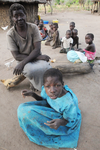 A 14-year-old Ugandan girl suffering from Nodding Syndrome.