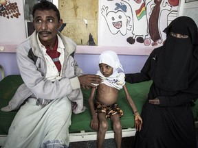 In this Nov. 15, 2018 photo, 10-year-old Affaf, who weighs 9,6 kg (21 pounds), sits with her parents at a hospital in Hajjah, Yemen. The U.N. food agency said Thursday, Dec. 6, 2018 it is planning to rapidly scale up food distribution to help another 4 million people in Yemen over the next two months, more than a 50-percent increase in the number reached now, if access can be maintained in the poor, war-stricken country.