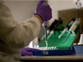 A scientist prepares samples for DNA analysis at Birmingham Women's Hospital on January 22, 2015 in Birmingham, England. Faulty sperm may be the reason why women suffer multiple miscarriages, scientists suspect, after finding that men whose partners struggle to carry a child to term have more DNA errors.