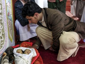 A Yemeni looks at the the faces of a pair of conjoined twin boys during their funeral in the capital Sanaa on February 10, 2019.