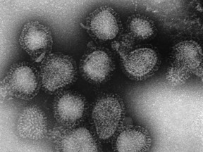 This 1975 electron microscope image made available by the Centers for Disease Control and Prevention shows a group of H3N2 influenza A virus virions. On Friday, March 8, 2019, health officials said there's a strong chance this flu season has peaked, but are watching a recent wave of illnesses from H3N2, a nastier flu strain.