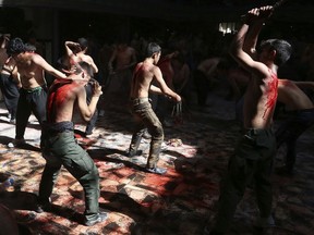 FILE - In this Sunday, Oct. 9, 2016 file photo, Shiite Muslim men beat themselves with knives attached to chains during a procession to mark Ashoura in Kabul, Afghanistan. In a report released on Wednesday, March 13, 2019, researchers say self-flagellation should be added to the list of ways to spread a dangerous viral blood infection.