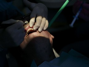 FILE- In this April 3, 2018, file photo, a dentist works on polishing and contouring the teeth of a patient at his dental office in Virginia Beach. Va. Roughly 1 in 4 Americans don't have dental coverage, according to industry figures. Employers are by far the biggest provider of dental coverage in the U.S., accounting for nearly half of all enrollees, followed by the government's Medicaid plan for low-income people.