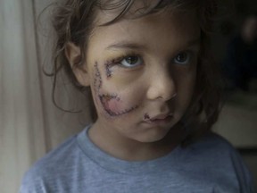 Karma Jariett, 6, after being mauled by a dog, is pictured at her grandmother’s home in West Windsor on Thursday, January 11, 2018.