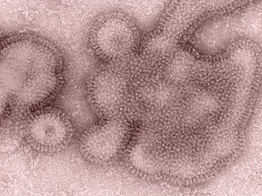 FILE - This 2011 electron microscope image provided by the Centers for Disease Control and Prevention shows H3N2 influenza virions. In January 2019, the flu season was shaping up to be one of the shortest and mildest in recent U.S. history. But a surprising second viral wave has just made it the longest, according to the flu statistics released on Friday, April 19, 2019.