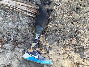 Dion Callaway 's $15,000 prosthetic awaiting a reunion with its owner.