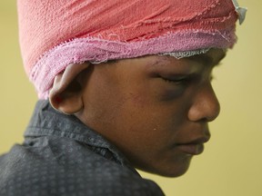 An injured boy receives treatment at a hospital after a rainstorm in Bara district in Birgunj, 136 kilometers (85 miles) from Kathmandu, Nepal, Monday, April 1, 2019. Villagers who survived a powerful rainstorm that killed at least 28 people and injured hundreds in southern Nepal searched for food and shelter Monday as rescuers struggled to reach remote areas.