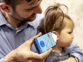 In this undated photo provided by the University of Washington in May 2019, Dr. Randall Bly uses a uses a phone app and a paper funnel to focus the sound, to check his daughter for an ear infection, at the UW School of Medicine in Seattle. Bly and other researchers at the school have developed the system to "hear" a warning sign of ear infections _ fluid build-up behind the eardrum.