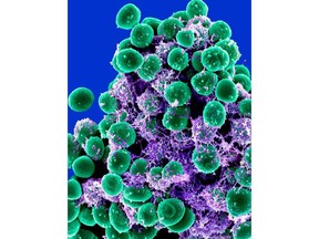 This 2011 digitally-colorized electron microscope image made available by the National Institute of Allergy and Infectious Diseases shows a clump of green-colored, spheroid-shaped, Staphylococcus epidermidis bacteria on a purple-colored matrix. We share our bodies with trillions of mostly friendly microbes that are important for things like good digestion. Now scientists are learning how that microbial zoo can change in ways that one day might let them predict who's at risk for brewing health problems. (NIAID via AP)