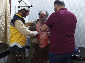 This photo provided by the Syrian Civil Defense group known as the White Helmets, shows a man who was injured in attack on a market receiving treatment at a hospital, in the village of Ras el-Ain, in the northwestern province of Idlib, Syria, Tuesday, May 7, 2019. Opposition activists say government forces have intensified their bombardment of rebel-held towns and villages in northwestern Syria where several people were killed. (Syrian Civil Defense White Helmets via AP)