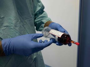 A surgeon holds a syringe prior to administering chemotherapy on June 7, 2019, at the Georges-Francois Leclerc centre in Dijon, central-eastern France.