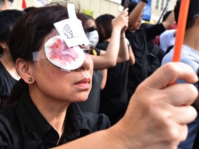 A supporter of the pro-democracy movement in Hong Kong wears an eyepatch and a drawing that depicts salt on a wound during a rally in Vancouver on Aug. 17, 2019.