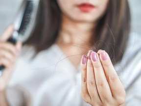 A woman holds hair removed from a hairbrush.  While there are steps that can be taken to prevent baldness, they are often costly and complex.