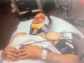 Const. Mike Chernyk is shown in a photo taken by police after he was run down by a car and then stabbed in Edmonton. The Edmonton Police Service officer broke down in tears as he told a jury about the 2017 attack.THE CANADIAN PRESS/HO-Alberta Court of Queen's Bench MANDATORY CREDIT