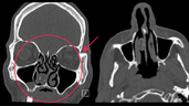 Reported in the British Medical Journal, the case appears to be one of a kind. 