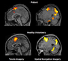 Images of “healthy” vs. “vegetative brains.”
