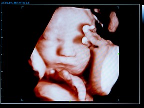 New technologies are pushing the boundaries of “fetal viability,” and challenging our ideas about confronting us with discomforting questions about abortion.