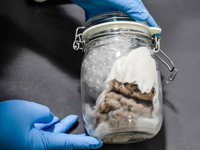 A U.S. Customs and Border Protection officer shows a human brain found in a Canada post shipment in this handout photo. U.S. border officials say they've seized a human brain that was found in a Canada Post shipment originating from Toronto.