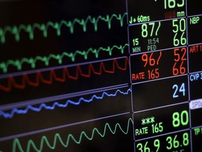 A screen displays a patient's vital signs during open heart surgery at the University of Maryland Medical Center in Baltimore on Nov. 28, 2016. A new medical review of the existing research into women's cardiovascular disease has uncovered what the authors call a "stunning" lack of information about how women are affected by the disease.