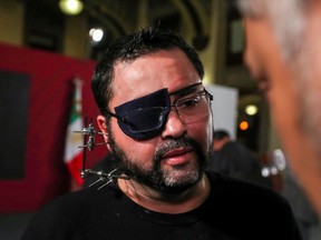 A Mexican video blogger Paul Velazquez, wearing a black eye patch and with metal surgical pins lodged in his face after surviving a murder attempt, looks on as Mexico's President Andres Manuel Lopez Obrador attends a news conference at the National Palace in Mexico City, Mexico February 5, 2020.