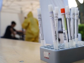 Vials of throat mucous swabs taken from visitors with symptoms to test them for Covid-19 infection stand outside a tent set up next to a medical practice on March 27, 2020 in Berlin, Germany.