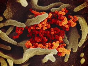 This undated electron microscope image made available by the U.S. National Institutes of Health in February 2020 shows the Novel Coronavirus SARS-CoV-2, orange, emerging from the surface of cells, green, cultured in the lab. Also known as 2019-nCoV, the virus causes COVID-19. The sample was isolated from a patient in the U.S. THE CANADIAN PRESS/AP-NIAID-RML via AP