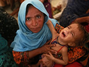 Mah Pari waits with her son Gul Mir on September 7, 2016, for her turn in the mobile feeding centre run by Médecins Sans Frontières in Dera Murad Jamali, Pakistan.