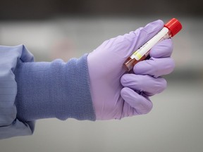 A laboratory technical assistant at LifeLabs, handles a specimen to be tested for COVID-19 after scanning its barcode upon receipt at the company's lab, in Surrey, B.C., on Thursday, March 26, 2020. Public health officials say Saskatchewan could see more than 250,000 cases of COVID-19 and around 3,000 deaths.