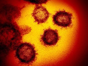 This undated electron microscope image made available by the U.S. National Institutes of Health in February 2020 shows the Novel Coronavirus SARS-CoV-2. Also known as 2019-nCoV, the virus causes COVID-19. Despite a surge in demand due to COVID-19, many distress centres across Canada are dangerously close to folding thanks to major declines in both volunteers and revenue. THE CANADIAN PRESS/AP, NIAID-RML