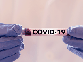 test tube with blood test result, covid-19, coronavirus