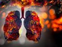 There is not convincing epidemiological data of an increased risk of emphysema or alveolar destruction. / Photo: Surasak Suwanmake / iStock / Getty Images Plus