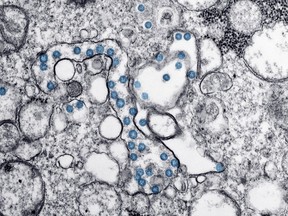 This 2020 electron microscope image made available by the U.S. Centers for Disease Control and Prevention shows the spherical particles of the new coronavirus, colorized blue, from the first U.S. case of COVID-19. Researchers in Canada say the best early-warning system for a second wave of COVID-19 may be right beneath our feet, in the sewers. THE CANADIAN PRESS/AP-Hannah A. Bullock, Azaibi Tamin/CDC via AP)