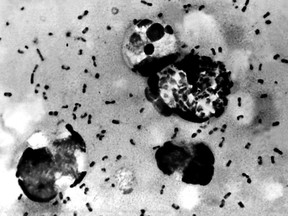 This Centers For Disease Control (CDC) file image obtained on January 15, 2003, shows the bubonic plague bacteria taken from a patient.