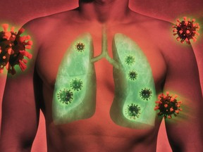 For a virus that was originally thought to target the lungs, it turns out it ravages almost every part of the. body. Stock/Getty