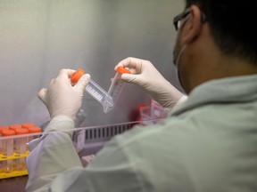 A technician cultivates lung cells as he preps for research into the infectivity of SARS-CoV-2 in human lungs at a laboratory at the University of Hong Kong  on Friday, March 20, 2020.