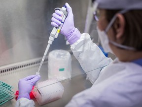 A laboratory technologist at LifeLabs in Surrey, B.C., demonstrates one of the steps taken when a specimen is tested for COVID-19, on March 26, 2020.