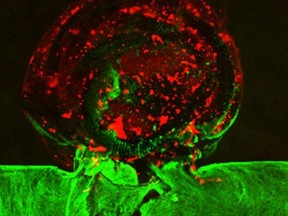 Using 3D printing, an LLNL team replicated an aneurysm in vitro and performed an endovascular repair procedure on the printed aneurysm, inserting a catheter into the blood vessel and tightly packing platinum coils inside the aneurysm sac.