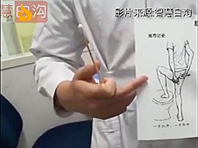 An instructional video shows how to self-administer an anal swab by inserting a cotton-tipped stick into the rectum.