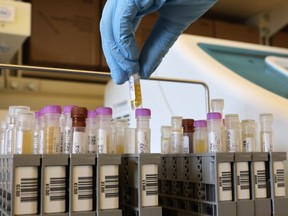 Researchers at the UW Medicine Retrovirology Lab at Harborview Medical Center work on samples from the Novavax phase 3 Covid-19 clinical vaccine trials on February 12, 2021 in Seattle, Washington.