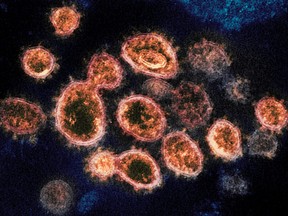 The SARS-CoV-2 virus particles, which cause COVID-19, isolated from a patient in the U.S., emerging from the surface of cells cultured in a lab in a 2020 electron microscope image provided by the National Institute of Allergy and Infectious Diseases - Rocky Mountain Laboratories.