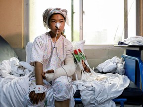 A girl injured by a May 8 car bomb outside a school that claimed 85 victims, mostly Hazara schoolgirls, receives treatment at a hospital in Kabul, Afghanistan, on May 10, 2021.