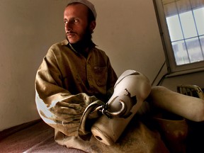 Ghulam Farooq, 26, had his right hand and left leg amputated by the Taliban at Kabul Sports Stadium in July 1998. He was accused of stealing money.