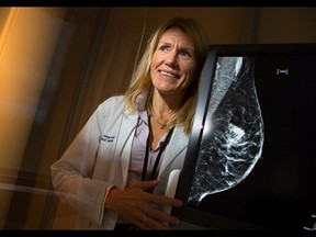 Dr. Jean Seely, head of breast imaging at The Ottawa Hospital, is a co-author of a new paper that disputes the decades-old findings of a study used to form breast cancer screening guidelines in Canada and around the world.