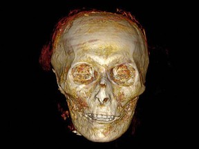 A computed tomography scan of the face of the Egyptian pharaoh Amenhotep I, who died in 1504 BCE