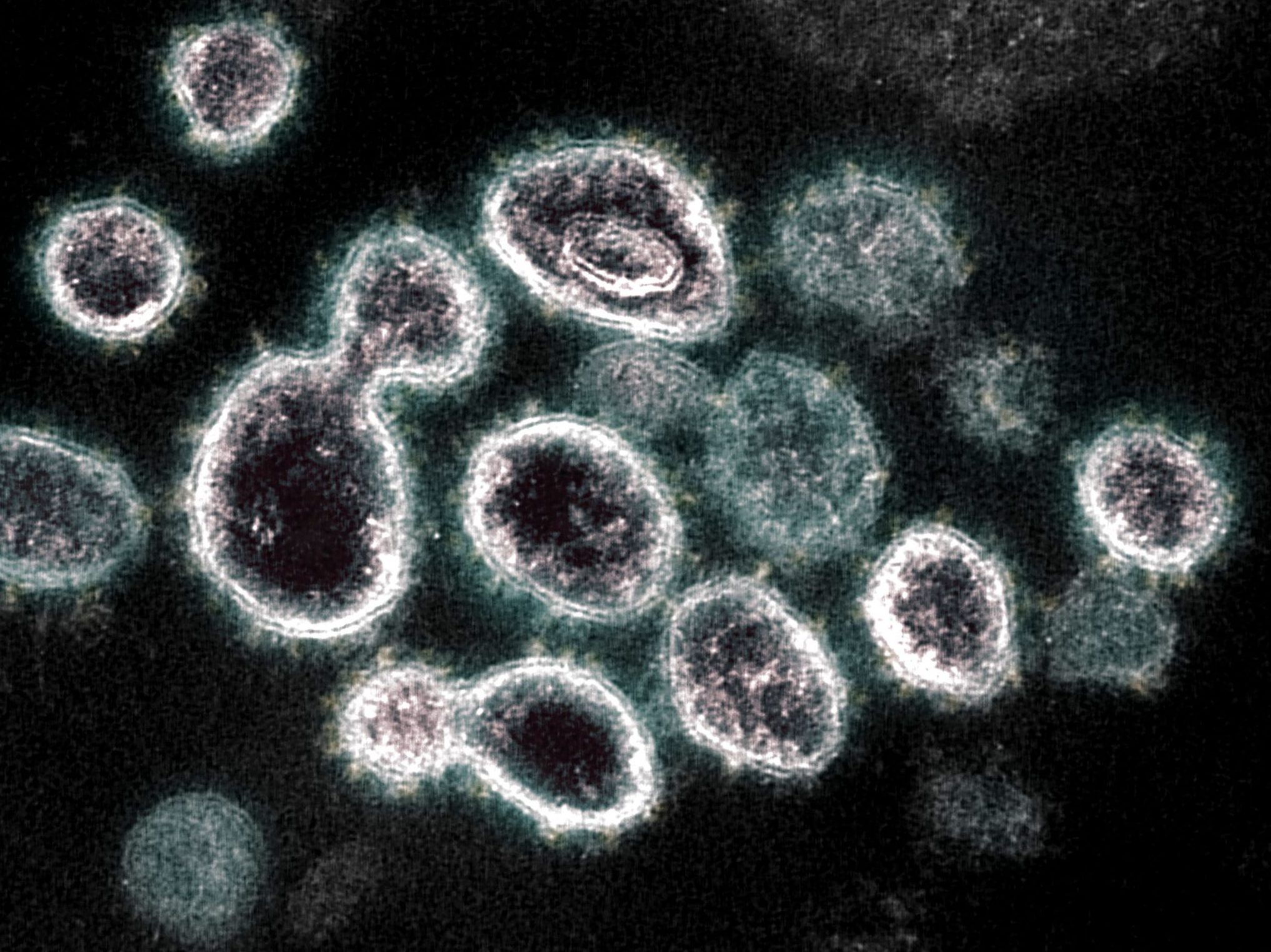 Unexplained’cryptic lineages’ of coronavirus found in New York City sewage. Is it the rats?