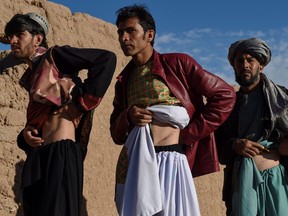 In this photo taken on Feb. 4, 2022, Afghan men who sold their kidneys pose for a picture showing their scars from the operation at Sayshanba Bazaar in the Injil district of Herat province.