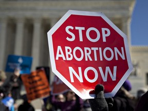 A demonstrator holds up a sign in support of pro-life rights outside the U.S. Supreme Court in Washington, D.C., U.S., on Wednesday, March 2, 2016.