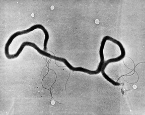 This is the least abhorrent image of syphilis that we could find.  Unfortunately, the centuries-old sexually transmitted disease is having a bit of a revival across Canada right now.  Click here to learn more.