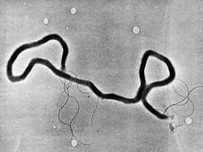 This is the least abhorrent image of syphilis that we could find. Unfortunately, the centuries-old sexually transmitted disease is having a bit of a revival across Canada right now. Click here to learn more.